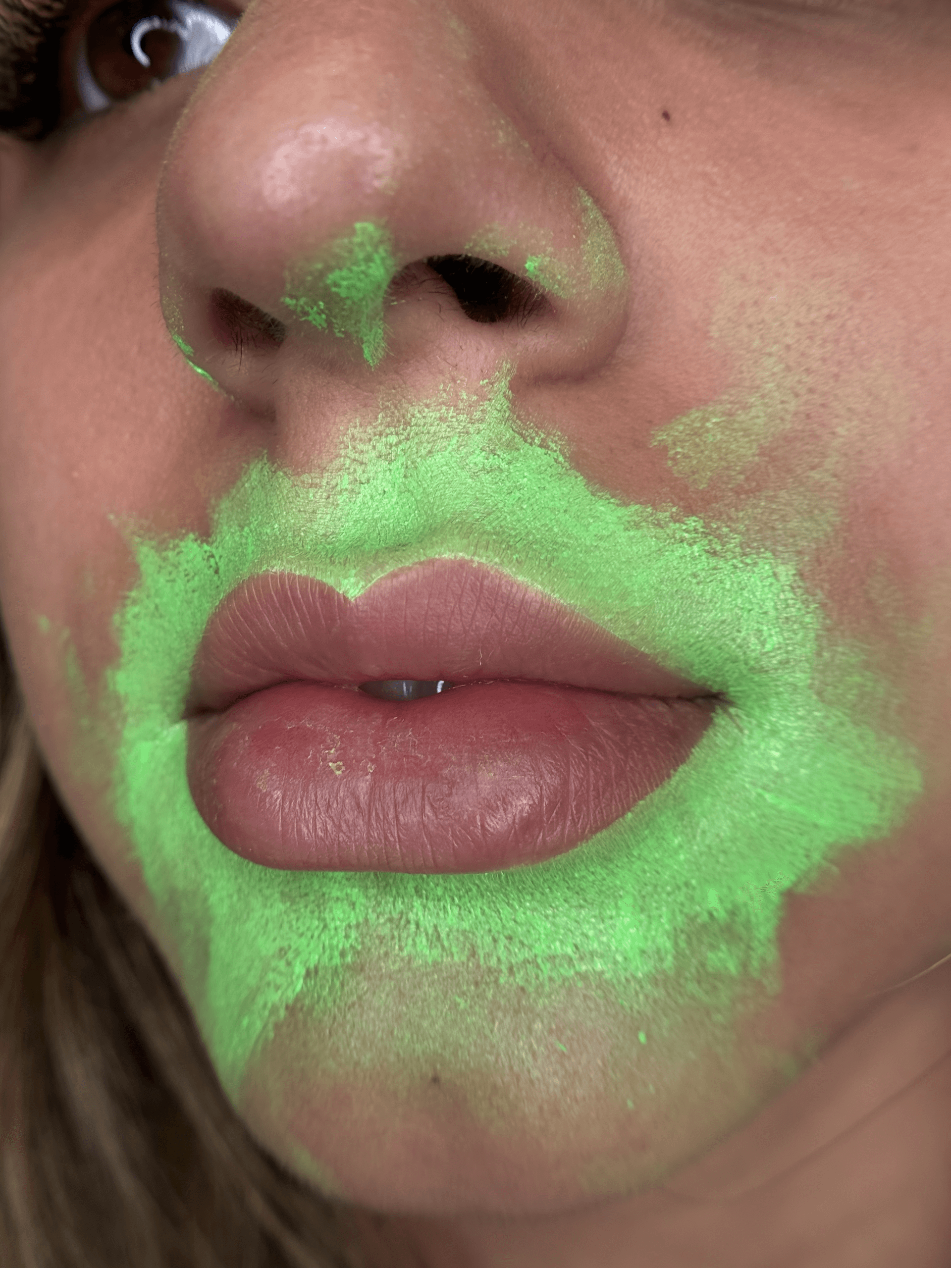 Diamond Lips - Stage 1